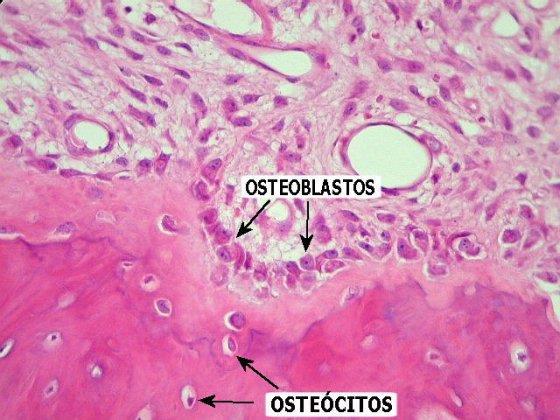 Tecido ósseo matriz orgânica e celular https://anatomiahumisabelprimera.wordpress.com/2014/12/07/composicion-y-funcion-del-tejido-oseo/ As células são: osteócitos, osteoblastos e osteoclastos.