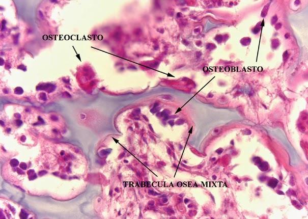 Tecido ósseo matriz orgânica e celular Os osteoclastos secretam colagenase e outras enzimas que atacam a matriz e liberam Ca 2+.