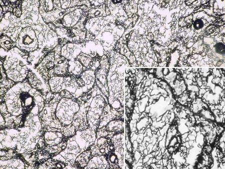 Tecido conjuntivo Fibras reticulares - Constituem o arcabouço de sustentação das células dos órgãos: http://www.icb.usp.br/mol/4-9freticulares1.
