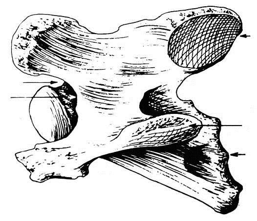 3ª A 7ª VÉRTEBRA CERVICAL -35- Face Articular caudal Forame Vertebral
