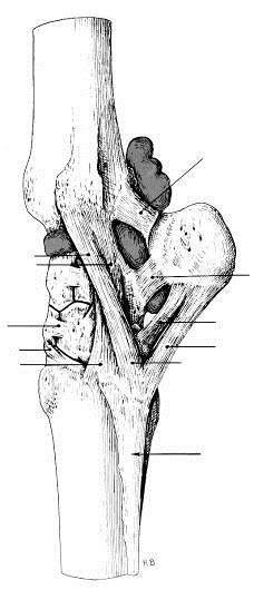 ARTICULAÇÕES SINOVIAIS -51- ARTICULAÇÃO CÁRPICA Ligamento Acessório-ulnar Ligamento colateral lateral Ligamento