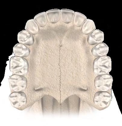 CAP. 3 ANATOMIA E ESCULTURA DENTÁRIA 3.7.