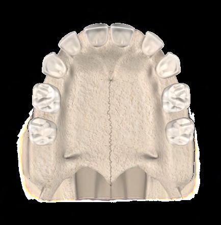 irrompem a partir do sexto mês de vida e o processo se completa até os dois anos e meio, com um total de vinte dentes. (fig. 3.