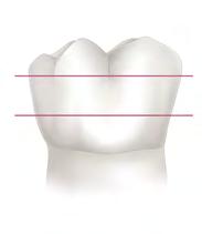 Incisivos Canino Pré-molares Molares 3.7.1 3.8. NOMENCLATURA DENTÁRIA Terceiro grupo: É constituído pelos dentes pré-molares (dois em cada hemiarco) e pelos dentes molares (três em cada hemiarco).