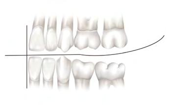 3.9. FÓRMULA DENTÁRIA É a maneira simplificada de especificar a quantidade de dentes em cada hemiarco. Cada dente é representado pela letra inicial. Na dentição decídua não existem dentes pré-molares.