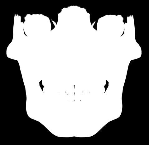 Osso maxilar Osso par, de formato quadrilátero, assemelha-se a uma pirâmide quadrangular de base voltada para o lado da cavidade nasal.