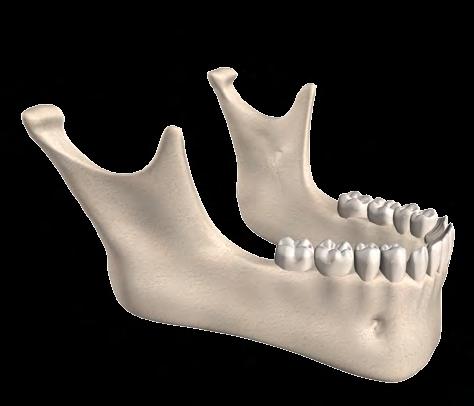 3.2.2.2. Osso mandibular Osso ímpar, situado na porção inferior da face, consiste de um corpo horizontal, curvo, que forma o mento (queixo), em forma de ferradura, com a concavidade voltada para a