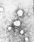 Vírus da Hepatite