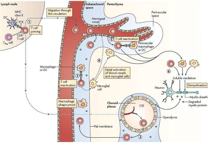 Imunopatogênese da Esclerose Múltipla