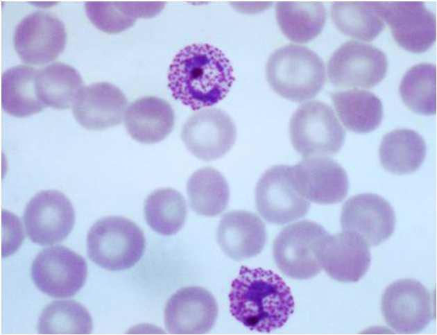 P. vivax Vs.