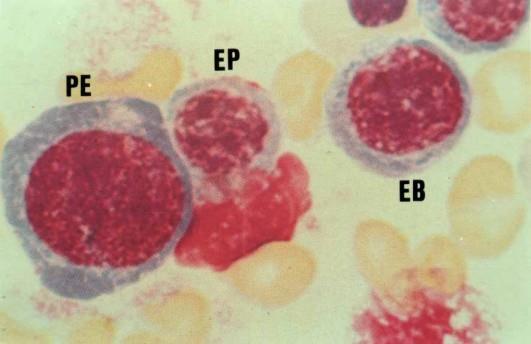 PE: próeritroblasto EB: eritroblasto