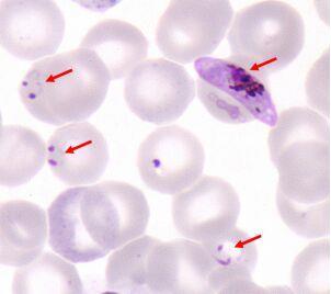 Agentes de doenças como a malária (Plasmodium) e a toxoplasmose (Toxoplasma).