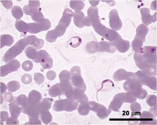 Doença de Chagas Diagnóstico Diagnóstico laboratorial