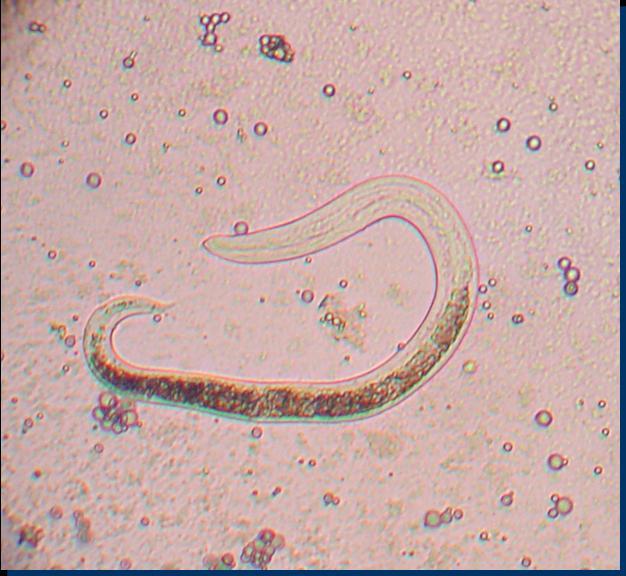 pinworm férgek hogyan kell hozni parazita 1 óra