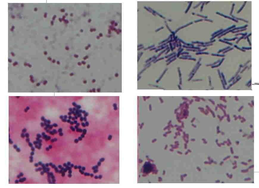 São exemplos de bactérias Gram-positivas várias espécies de: - Estreptococos; - Estafilococos; -