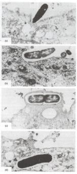 membrana expostas na superfície bacteriana que proporcionam adesão ou invasão de células do hospedeiro; Alvos potenciais para vacinas; E.