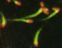 Pedestal de actina Estratégias intracelulares Bactérias intracelulares obrigatórias Bactéria intracelulares facultativas Listeria