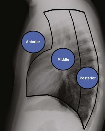 médio / visceral ; posterior / paravertebral) RADIOGRAFIA EM