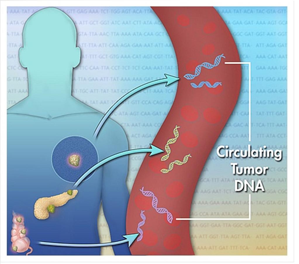 Biópsia líquida -ctdna Desafios na detecção do DNA tumoral circulante(ctdna): 1- A discriminação do ctdna do cfdna.