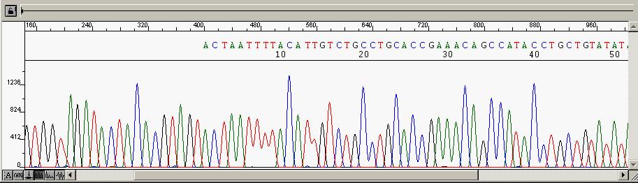 49 A. B. FIGURA 9 - Eletroferogramas referentes ao sequenciamento. A) Infecção simples. Sequência nucleotídica referente ao HPV 70. B) Infecção múltipla. Sobreposição de sequências virais.