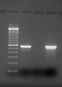 admissível para o tratamento com DNase (15µl) limitando a quantidade de cdna disponível para os ensaios de PCR em tempo real.