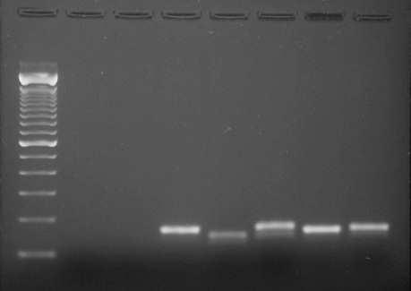 Electroforese em gel de agarose a 1,5% após amplificação por PCR tempo real dos primers: lpp1330, lpp0094, lpp1315, lpp1177 e lpp1170.