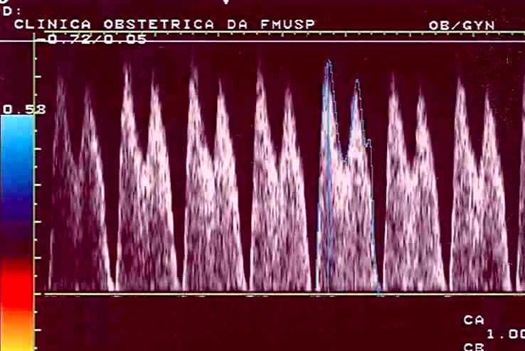 Métodos 43 Figura 2- Sonograma do