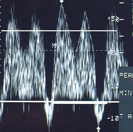 onda a Figura 3 - Sonograma do