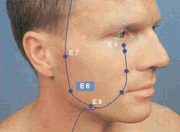 E 5 (TA ING) Situa-se na união da margem anterior do músculo masseter com a margem inferior do corpo da mandíbula, próximo a artéria facial. É o ponto que rege a mandíbula.