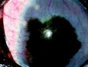Normalmente o muco acumulado é parte integrante do filme lacrimal que não é drenado pelo sistema lacrimal. A FIGURA 2 Olhos de cães acometidos por CCS.