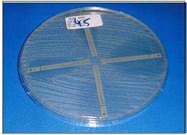 SUSCETIBILIDADE E RESISTÊNCIA AOS ANTIFÚNGICOS ANTIFÚNGICOS Entende-se por antifúngico ou antimicótico a toda a substância que tem a capacidade de evitar o crescimento de alguns tipos de fungos ou