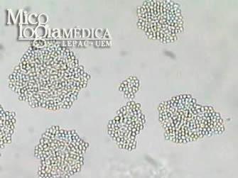 pseudotropicalis, e ocasionalmente a espécies muito resistentes de C. lusitaniae.