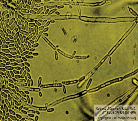 C. krusei C. lusitaniae RESISTÊNCIA DE Candida spp.