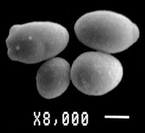 ESPÉCIES: 3 TIPOS RESISTÊNCIA RESISTENCIA ADQUIRIDA: após exposição à droga, alguns membros, ou todos, tornam-se resistentes. Ex.: C. glabrata,c. albicans,c. parapsilosis, C.