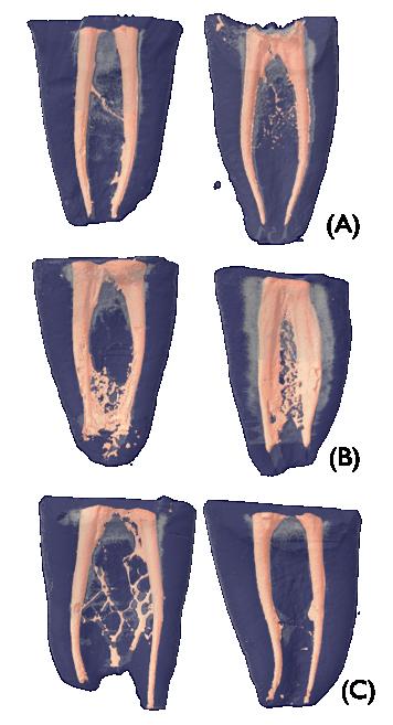 Figura 12: Imagem microtomográfica de dois espécimes