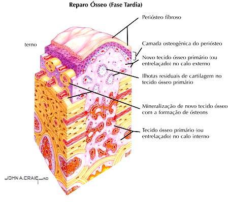 Reparo da Fratura Óssea Periósteo fibroso Camada osteogênica do periósteo Novo tecido ósseo primário no calo externo Ilhotas residuais de cartilagem no tecido ósseo primário