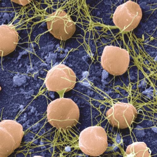 25 / 32 Temperaturas Pyrococcus