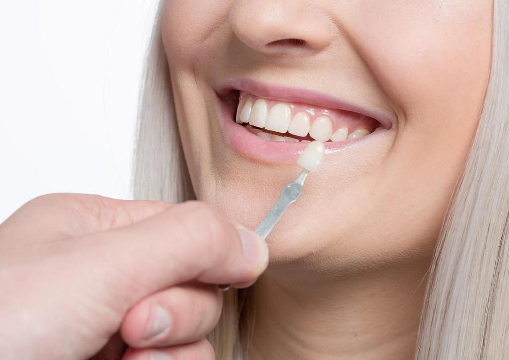 Sorrisos tortos corrigidos em poucos dias : Uma das principais indicações das Lâminas de Porcelana ou Lentes de Contato Dental são as correções de pequenas distorções nos dentes.