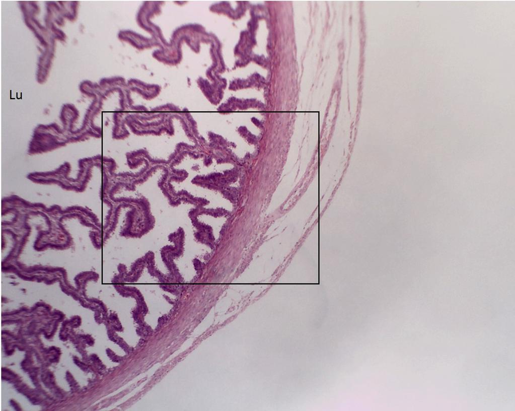 PRÁTICA 04: TUBA UTERINA LÂMINA: TUBA UTERINA (HE) PROCEDIMENTO 1) Na objetiva 04 observar a mucosa da tuba uterina altamente pregueada.