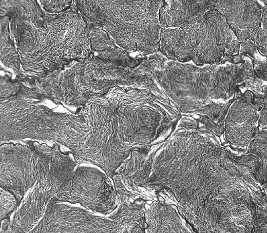 18 Aspecto microscópico: - Histologicamente observam-se os túbulos seminíferos repletos de espermatozóides formando uma massa contínua, que adquire o aspecto de ondular dinâmico, com as caudas