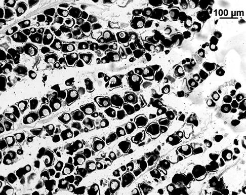 Aspecto microscópico: - Observou-se à periferia dos oócitos uma zona de aspecto granuloso, envolvendo-os completamente ou em parte, que apresentava menor afinidade para os corantes utilizados.