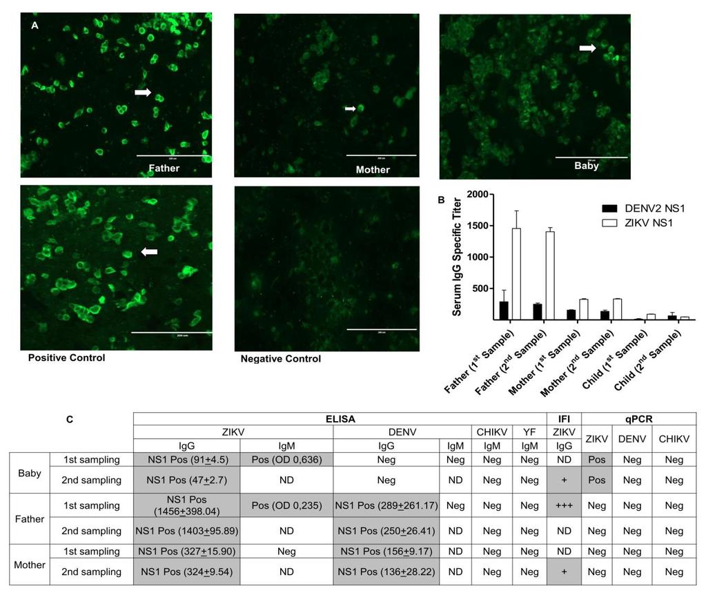 Detection of Zika virus antibodies in sera from patients.