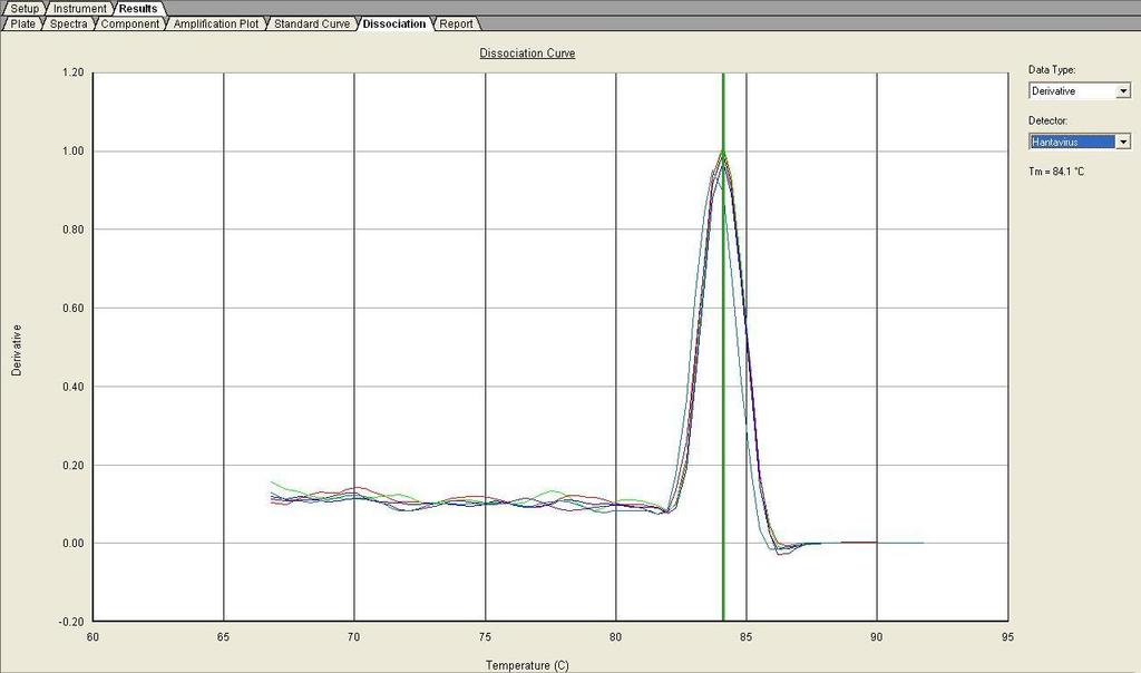 Zika virus detection by real-time PCR based on the SYBR- Green method as a diagnosis more accessible for developing