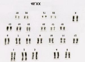 ou cromossomas sexuais (XX no sexo