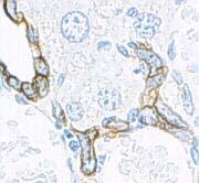 [40] 2) Melanócitos: representam aproximadamente 2% das células epidérmicas e encontram-se na camada