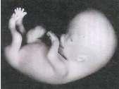 separar. Embrião com cerca de 56 dias: as membranas que uniam os dedos já desapareceram.