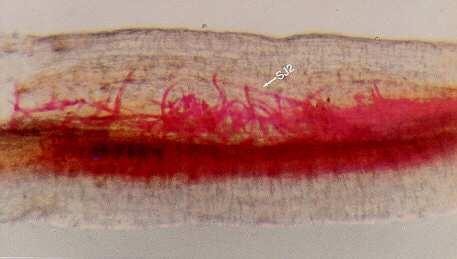 Fusarium oxysporum f.sp. vasinfectum Quebra de resistência em cvs.