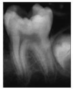 Imagem 2- Imagem ilustrativa de radiografia pré-operatória de um paciente de 7