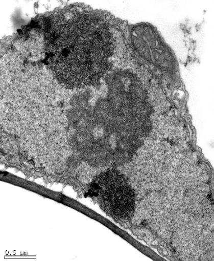 Massas de vírions no lúmen do retículo endoplasmático estão indicadas pelas setas (*) viroplasma.