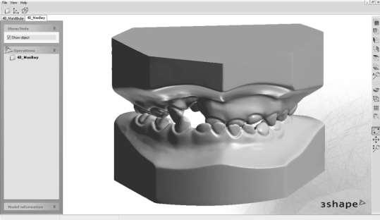 62 2 Revisão de Literatura Fonte: Chawla et al., 2011 Figura 14: Imagem tridimensional obtida de modelos de gesso escaneados.